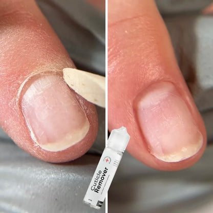 NAILSOFTHEDAY Cuticle Remover – регенерирующий ремувер для кутикулы с мочевиной 10%, 60мл