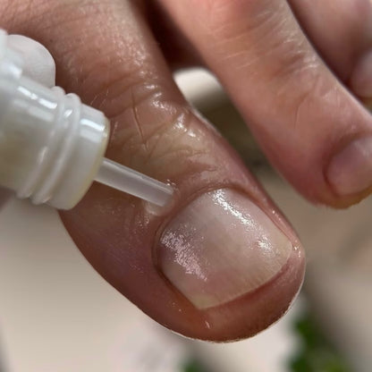 Resultum Onistopix Oil – regenerierendes Nagelöl für beanspruchte Nägel, Onycholyse-Pflege & intensive Nagelhautpflege