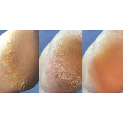 Nailsoftheday Podology+ Крем от трещин для рук и стоп, 30 мл — Увлажнение и восстановление с мочевиной 12%